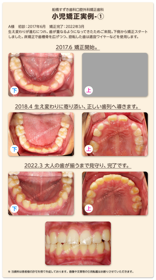 GPのための床矯正・矯正のすすめ 活用編 - 健康・医学