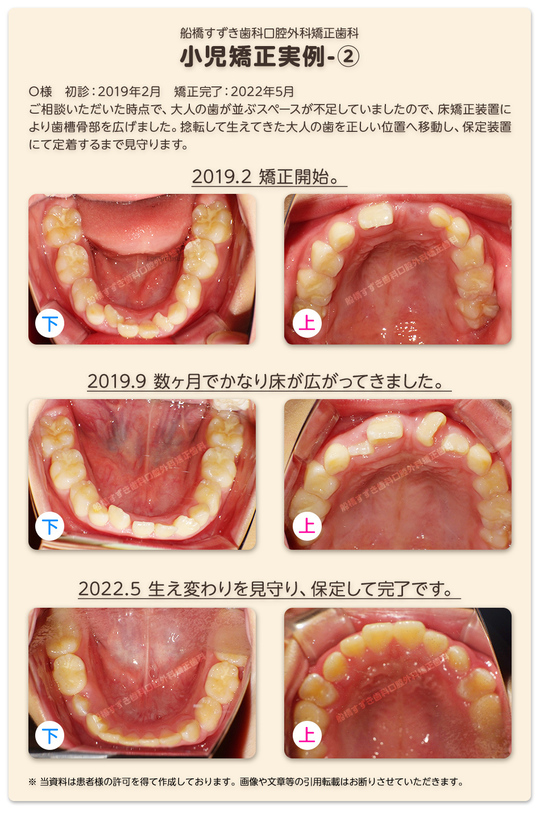 臨床医のための床矯正・矯正治療 2巻セット 昭和 臨床医のための床矯正・矯正治療 基礎篇 、症例編 2冊